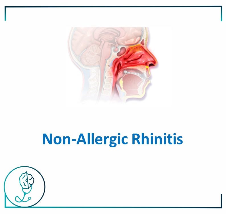 Non-Allergic Rhinitis